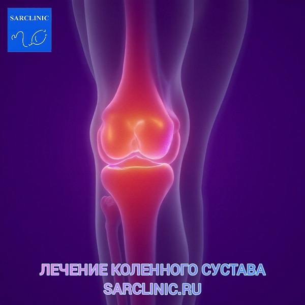 лечение коленного сустава в саратове, лечение коленного сустава в россии