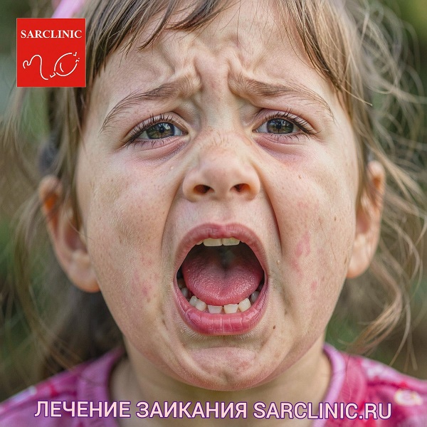 заикание у детей, заикание у подростков, заикание у взрослых